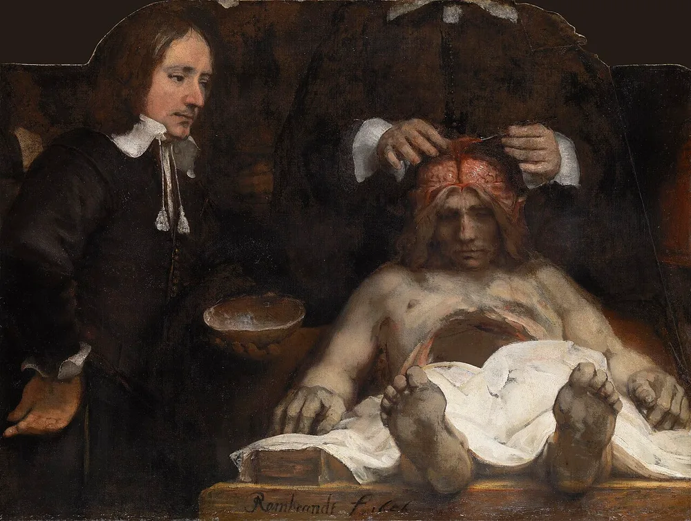 La Leçon d'anatomie du Docteur Joan Deyman, Rembrandt, 1656